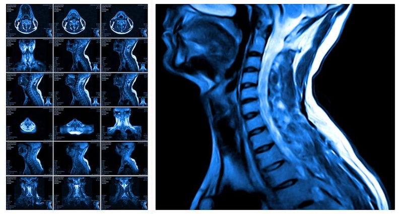 xray of the spine 2